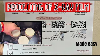 PROCESSING OF X-RAY FILM || ORAL RADIOLOGY