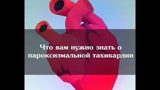 Что вам нужно знать о пароксизмальной тахикардии