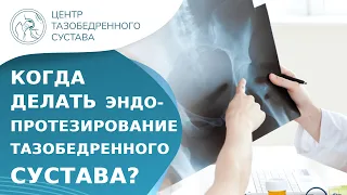 ❓ Когда нужно делать операцию на тазобедренном суставе? Когда нужно делать эндопротезирование ТБС.