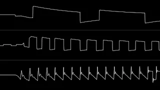 Jeroen Tel - “Hawkeye (C64)” [Improved Oscilloscope View]