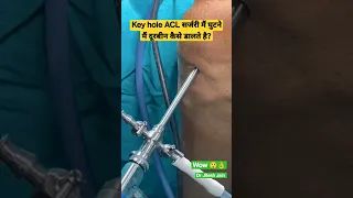 Key hole ACL सर्जरी मैं घुटने मैं दूरबीन कैसे डालते है? Dr Jitesh Jain #shorts #aclsurgery #acl