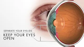 Intravitreal Injections  Overview
