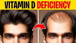 4 Hormone Deficiencies That Cause hair Thinning