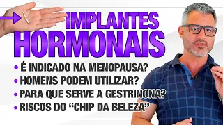 IMPLANTE HORMONAL é perigoso? Quando é indicado fazer?  🤔⚠