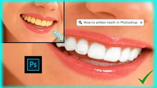 Whiten your teeth EASILY by doing this in Adobe Photoshop 2023