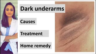 How to get rid of Dark underarms | causes|  treatment| home remedy| Dermatologist | Dr. Aanchal