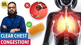 BEST Way to Clear Out MUCUS from Lungs | Khushk Khansi/Balghami Khansi | Dr. Ibrahim