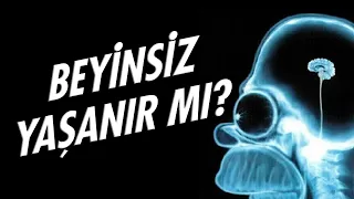 Beynimiz olmadan yaşayabilir miyiz?