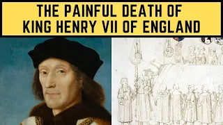 The PAINFUL Death Of King Henry VII Of England