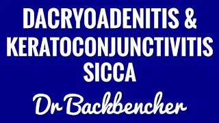 Dacryoadenitis, Keratoconjunctivits Sicca (Dry Eye Syndrome) - Ophthalmology