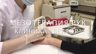 МЕЗОТЕРАПИЯ РУК - в клинике "ВЕКТОР"