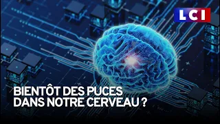 Aura-t-on bientôt des puces intégrées à notre cerveau ?