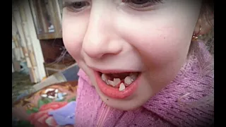 Как вырвать ребёнку зуб / Лайвхак