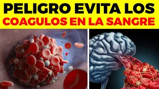 ¡ALERTA! Por Esta Razón Te Salen COÁGULOS EN LA SANGRE, , no lo hagas tu cerebro te lo agradecerá