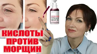 Кислоты против морщин и лучшие кислотные средства антиэйдж!