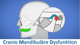 CMD - Welchen Einfluss hat die Kiefer- und Zahnstellung auf unseren Körper?
