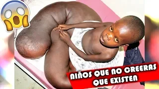 5 NIÑOS👦 mas RAROS y EXTRAÑOS 😵que NO CREERÁS QUE EXISTEN😱