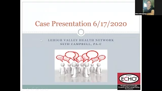 Project ECHO - June 17, 2020 -  Introduction to Motivational Interviewing