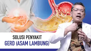 Gerd (Penyakit Asam Lambung): Gejala, Penyebab dan Cara Mengatasi | KATA DOKTER