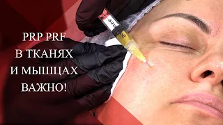 💉PRP и PRF в тканях и мышцах | ЧТО ВАЖНО ЗНАТЬ!