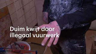 Anthony is zijn duim kwijt door illegaal vuurwerk: 'De wond gaat elk jaar open' - RTL NIEUWS