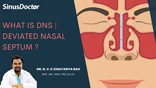 What is DNS | Deviated nasal septum - Dr.GVK Chaitanya Rao