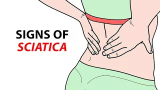 Signs of Sciatica