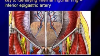 Sonography of the Hernias