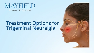 Facial Pain Treatment, Treatment Options for Trigeminal Neuralgia