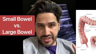 Differentiating small bowel from large bowel (specifically ileum vs cecum)