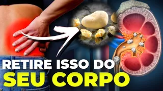 PEDRA NOS RINS: O ato simples que você NÃO ESTÁ FAZENDO