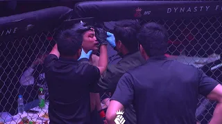 [MMA] JAY ESPAREZ VS CHRISTOPHER JIM MEDINA | 20240526