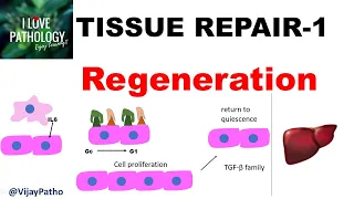 TISSUE REPAIR  Part 1: Repair - Regeneration