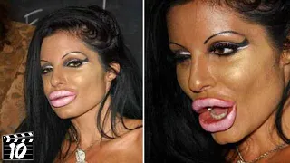 Top 10 Celebrities You Won't Recognize After Plastic Surgery - Part 5