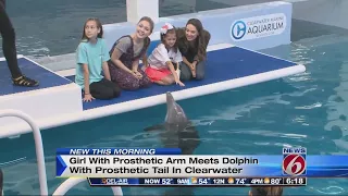 Girl with prosthetic arm meets dolphin with prosthetic tail
