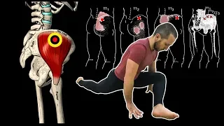 The gluteus medius muscle 📢 anatomy, function, trigger points, therapeutic exercises