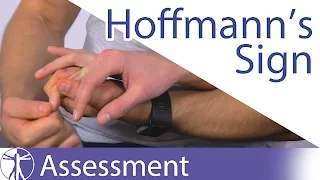 Hoffmann's Sign or Reflex | Upper Motor Neuron Lesion