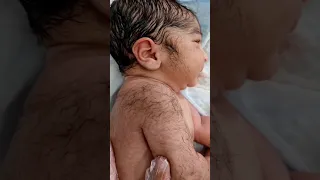 Hairy & Beard from First Day of Life of Cute Newborn baby @AfterBirth