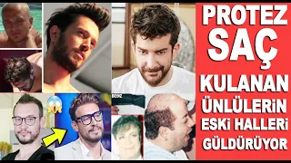 Protez saç kullanan ünlü isimlerin değişimi sizi çok şaşırtacak!