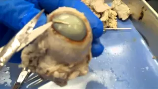 NEW - Cow Eye Dissection:  Video Lab Series