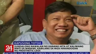 Sundalong nawalan ng kanang hita at kaliwang binti sa Marawi, hinandugan ng prosthetic legs
