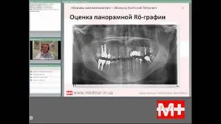 Онлайн-лекция по основам имплантологии - 4 - www.medinarius.com.ua