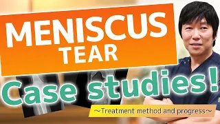Treating meniscus tear with regenerative medicine - Learn from actual cases [Doctor's commentary]