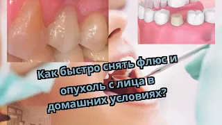 Как быстро снять флюс и опухоль с лица в домашних условиях?