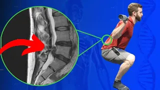 How To Squat With A Herniated Disc