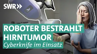 Cyberknife-Behandlung als Operationsmethode gegen Tumore | Doc Fischer SWR