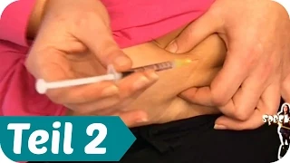"20 Kilo weniger mit Schwangerschaftshormonen" - Speck weg! (2/5) | taff