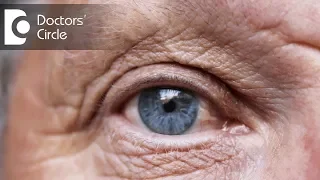 Who are at risk for Age Related Macular Degeneration - Dr. Sunita Rana Agarwal