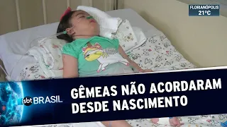 Duas bebês gêmeas dormem desde nascimento e desafiam médicos | SBT Brasil (06/12/19)