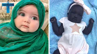 TOP 10 UNUSUAL BABIES YOU'VE NEVER SEEN IN THE WORLD